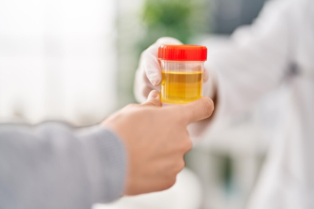 The Complete Guide to Kidney Function Tests: What You Need to Know