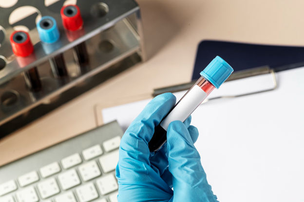How Blood Testing for Vitamin Deficiencies Can Revolutionize Your Health Journey