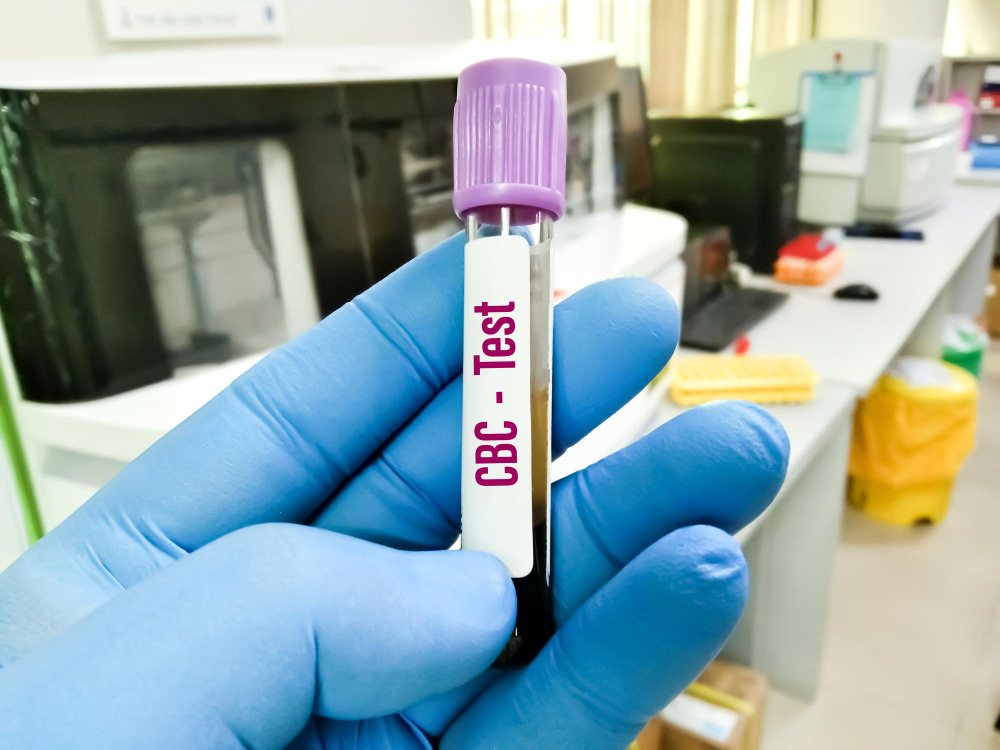 Complete Blood Count (CBC) Test: Understanding Your Blood Report and Health Indicators